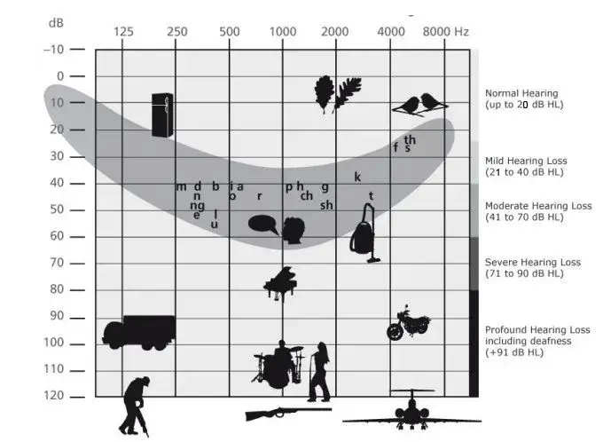 Zdjęcie Audiogram - jak wygląda badanie słuchu i ile faktycznie trwa u specjalisty